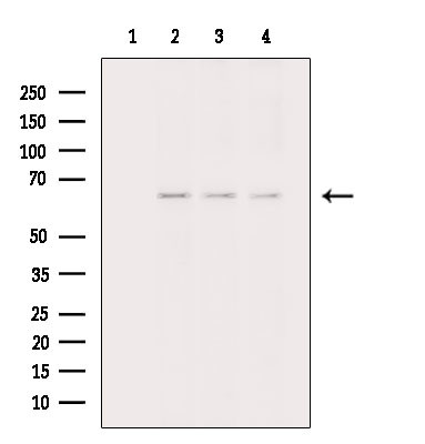 Collagen X Antibody in Western Blot (WB)