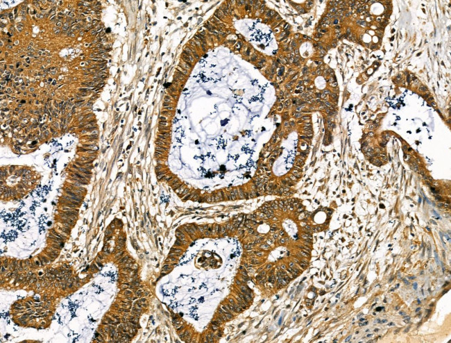 Collagen X Antibody in Immunohistochemistry (Paraffin) (IHC (P))