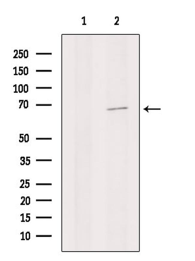 Collagen X Antibody in Western Blot (WB)