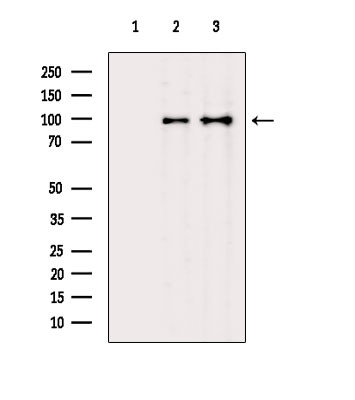 COPG Antibody in Western Blot (WB)