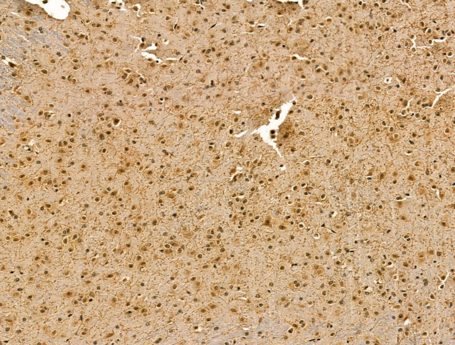 RCOR1 Antibody in Immunohistochemistry (Paraffin) (IHC (P))