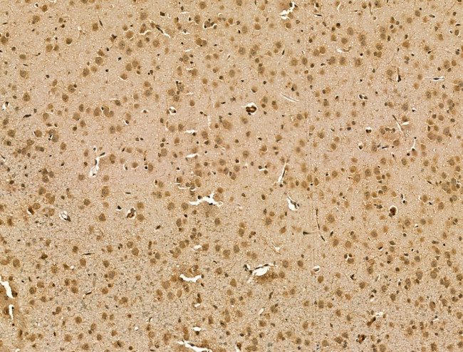 RCOR1 Antibody in Immunohistochemistry (Paraffin) (IHC (P))