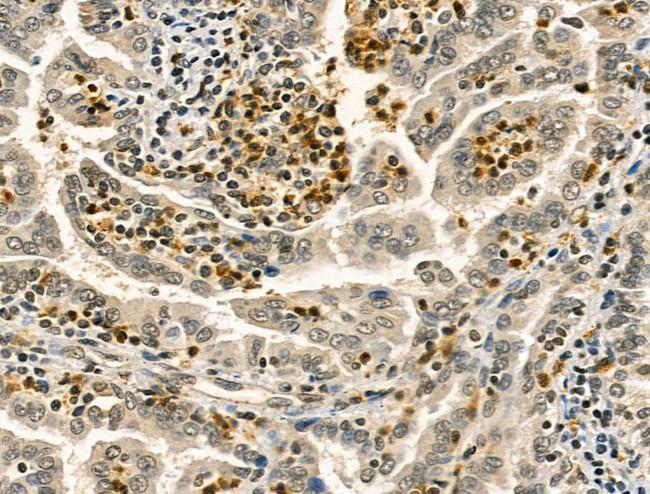 RCOR1 Antibody in Immunohistochemistry (Paraffin) (IHC (P))