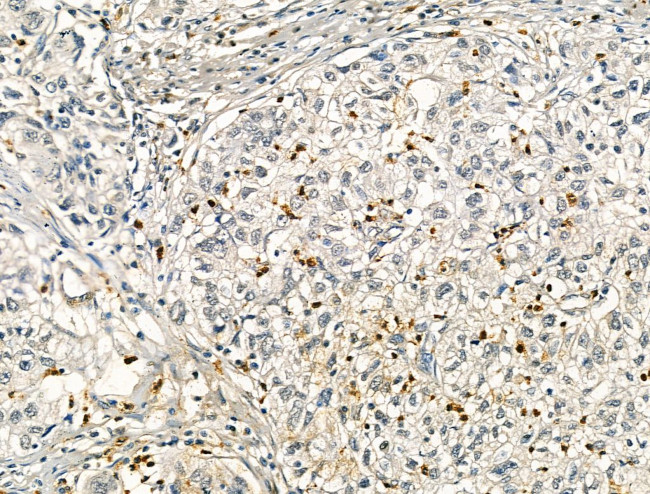 RCOR1 Antibody in Immunohistochemistry (Paraffin) (IHC (P))