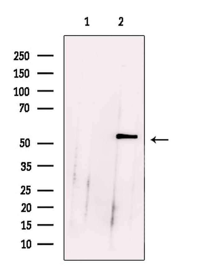 RCOR1 Antibody in Western Blot (WB)