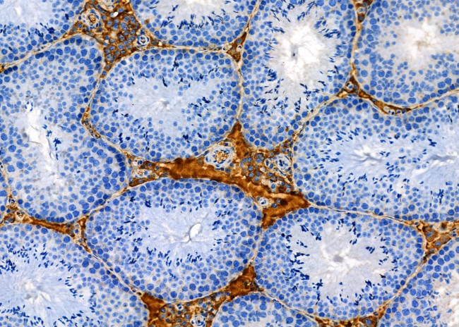 COX10 Antibody in Immunohistochemistry (Paraffin) (IHC (P))