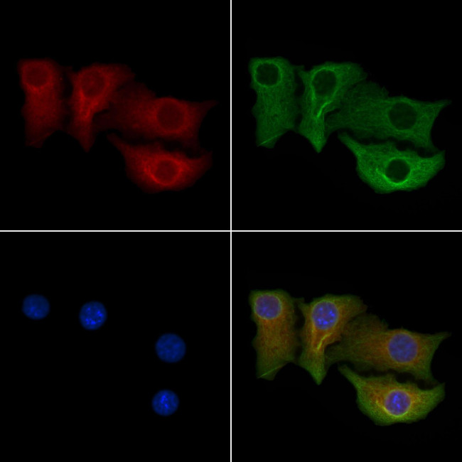 CPEB4 Antibody in Immunocytochemistry (ICC/IF)