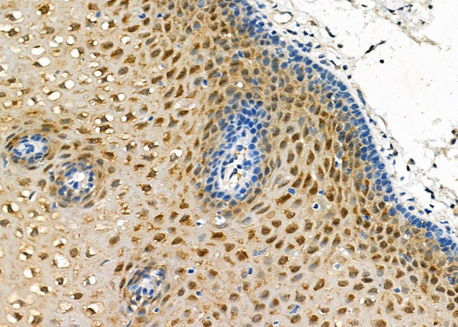 CRABP2 Antibody in Immunohistochemistry (Paraffin) (IHC (P))