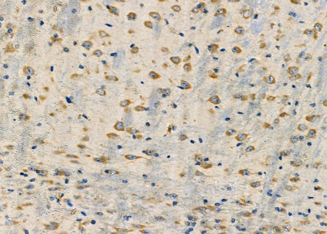 CRABP2 Antibody in Immunohistochemistry (Paraffin) (IHC (P))