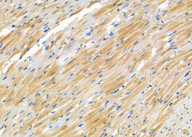 CRABP2 Antibody in Immunohistochemistry (Paraffin) (IHC (P))