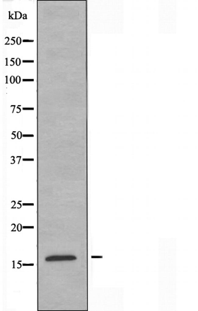 CRABP2 Antibody in Western Blot (WB)