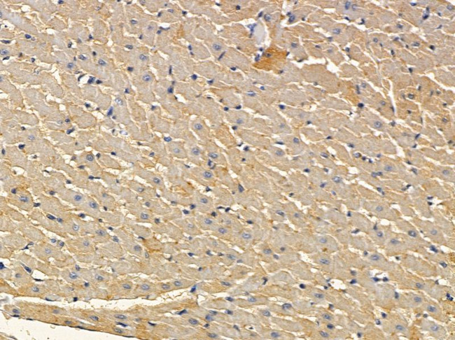 CSF2RB Antibody in Immunohistochemistry (Paraffin) (IHC (P))