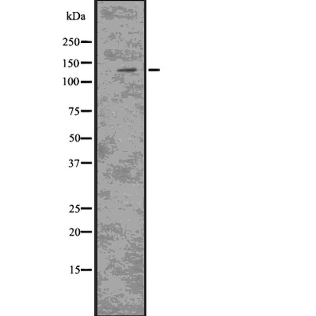 CSF2RB Antibody in Western Blot (WB)