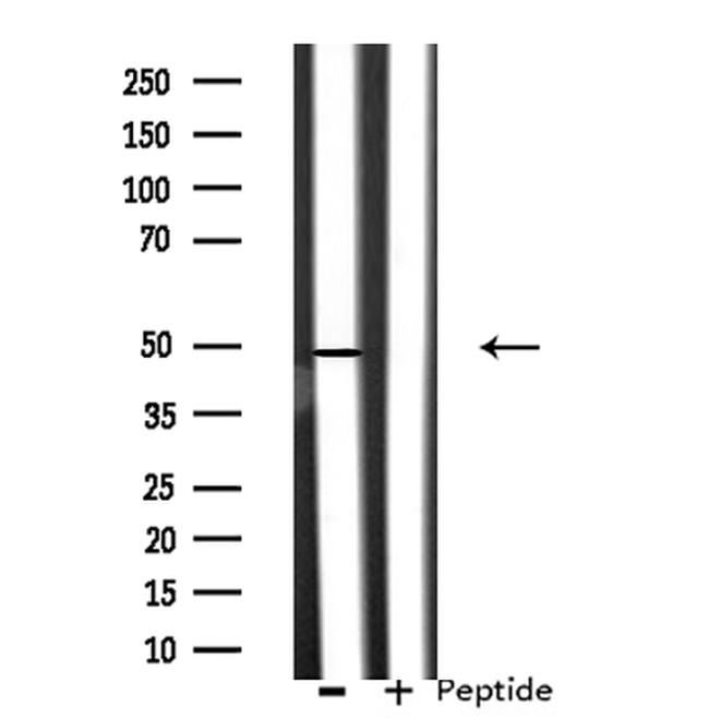 CSTF1 Antibody in Western Blot (WB)