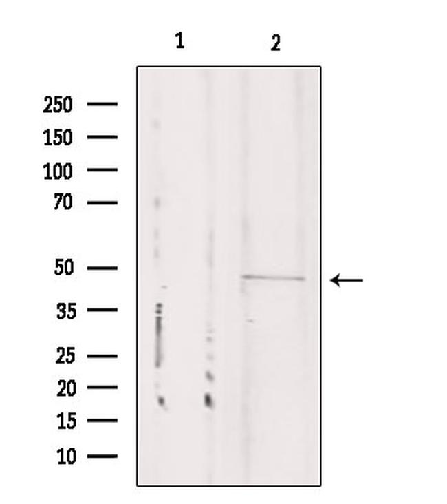 CSTF1 Antibody in Western Blot (WB)