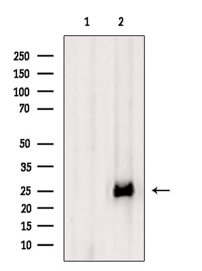 CTLA-4 Antibody in Western Blot (WB)