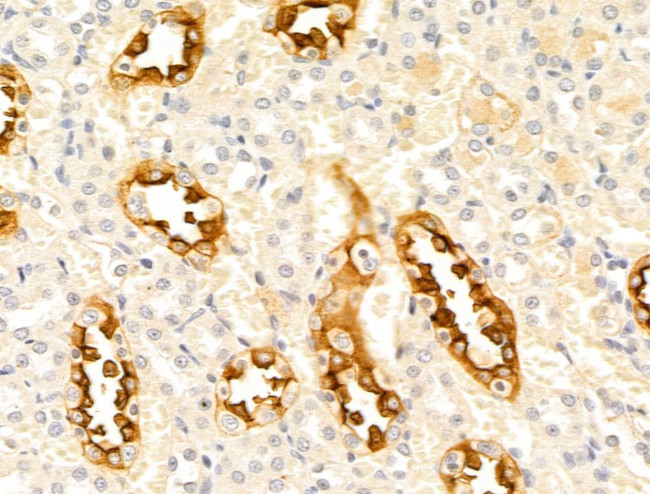 CTRP3 Antibody in Immunohistochemistry (Paraffin) (IHC (P))