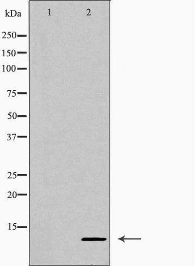 CXCL10 Antibody in Western Blot (WB)