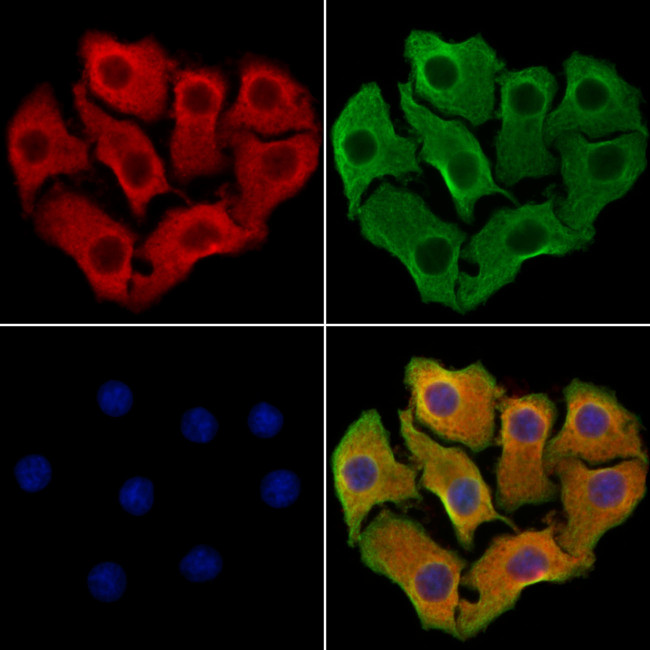 CXCL16 Antibody in Immunocytochemistry (ICC/IF)