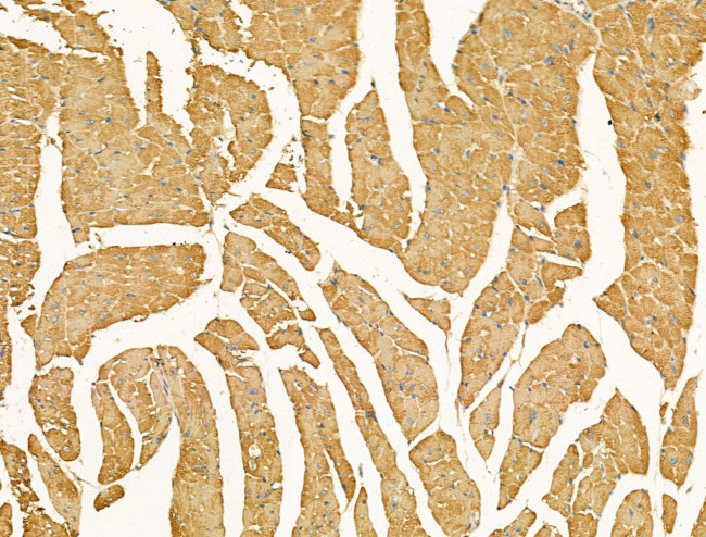 CXCL16 Antibody in Immunohistochemistry (Paraffin) (IHC (P))