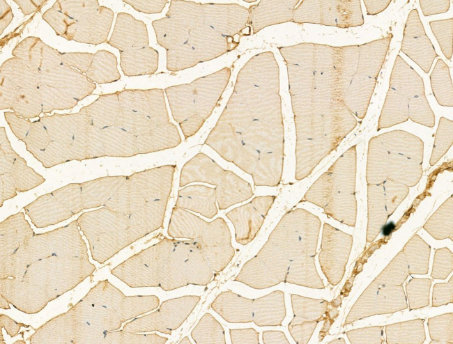 CXCL16 Antibody in Immunohistochemistry (Paraffin) (IHC (P))