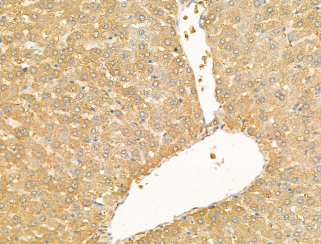 CXCL16 Antibody in Immunohistochemistry (Paraffin) (IHC (P))