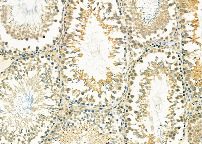 CXCL5 Antibody in Immunohistochemistry (Paraffin) (IHC (P))