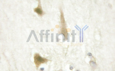 Cyclin D1 Antibody in Immunohistochemistry (Paraffin) (IHC (P))