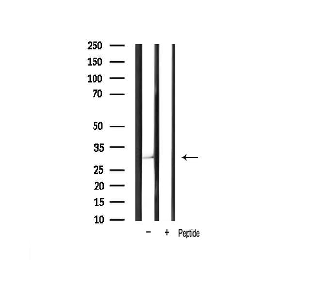 Cyclin D1 Antibody in Western Blot (WB)