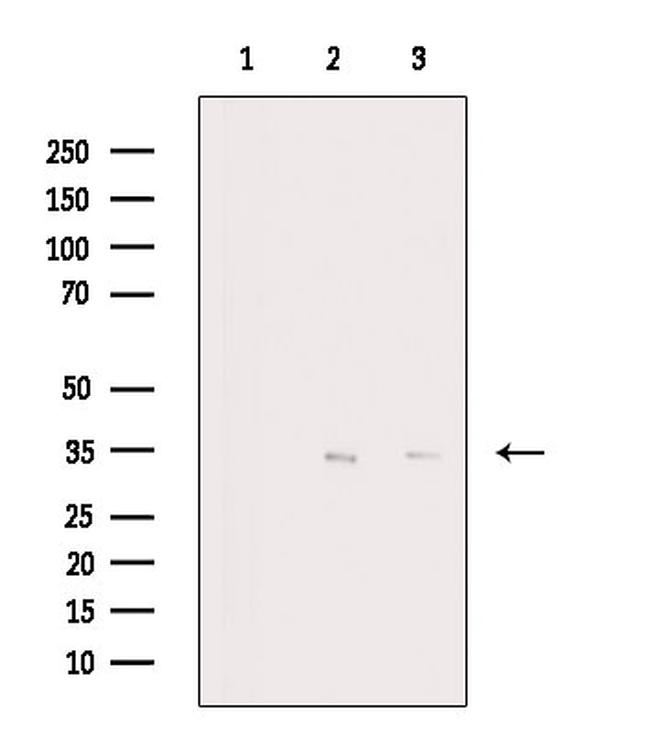 Cyclin D1 Antibody in Western Blot (WB)