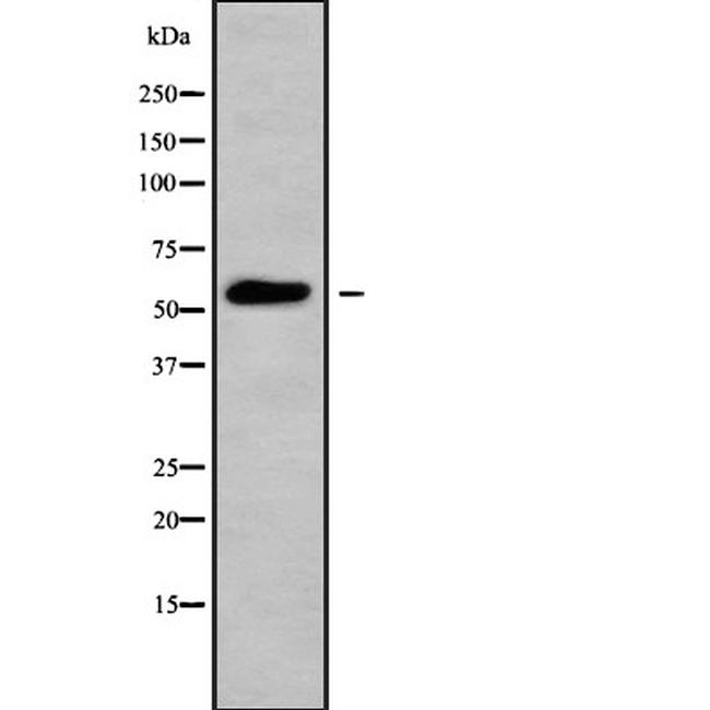 CYP26A1 Antibody in Western Blot (WB)