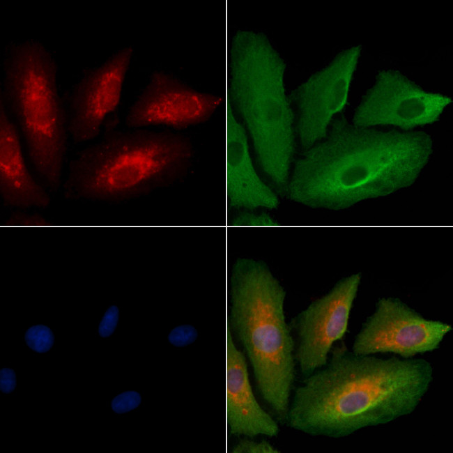 MTCO1 Antibody in Immunocytochemistry (ICC/IF)