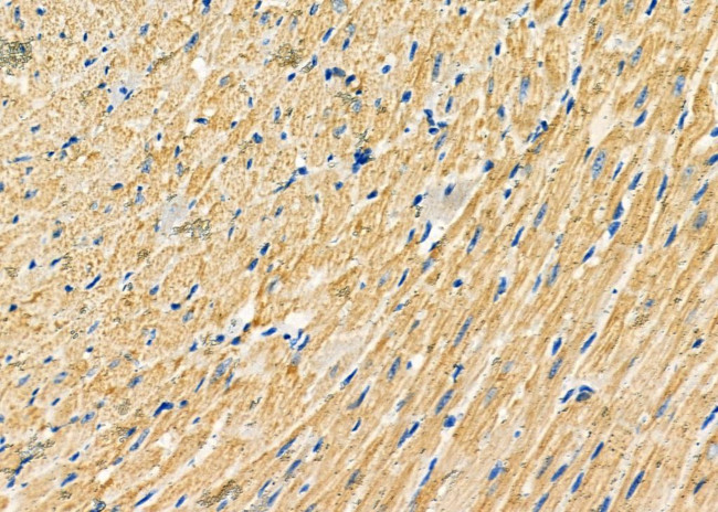 MTCO1 Antibody in Immunohistochemistry (Paraffin) (IHC (P))