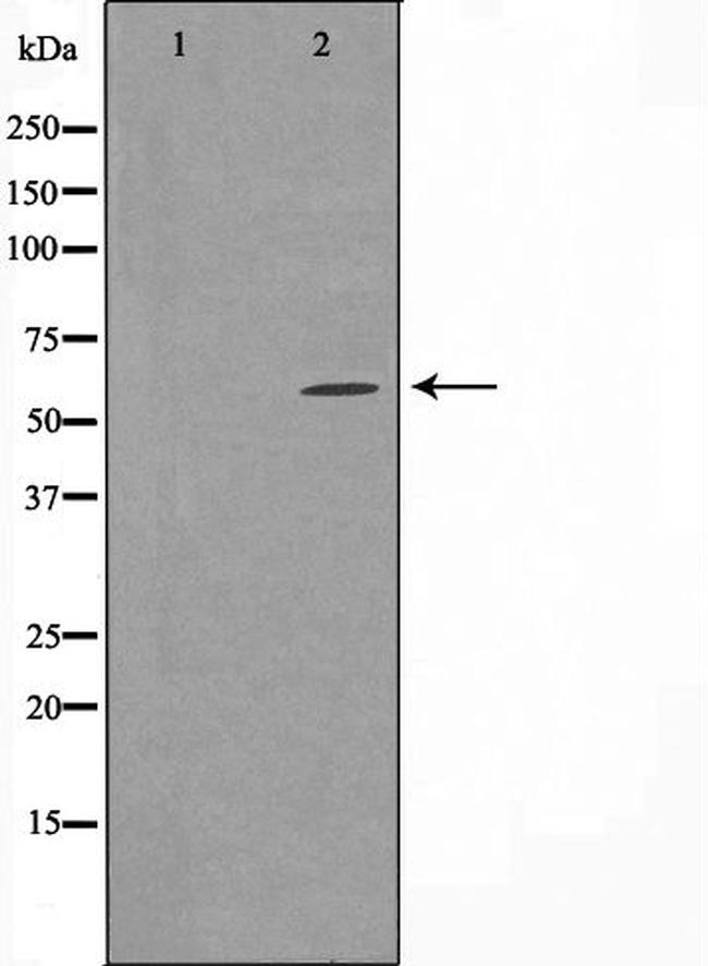 CYP24A1 Antibody in Western Blot (WB)