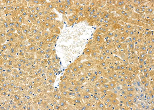 CYP2D6 Antibody in Immunohistochemistry (Paraffin) (IHC (P))