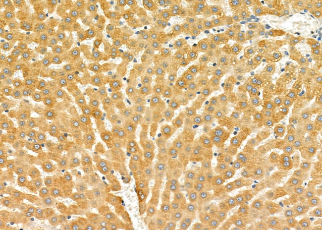 CYP2D6 Antibody in Immunohistochemistry (Paraffin) (IHC (P))