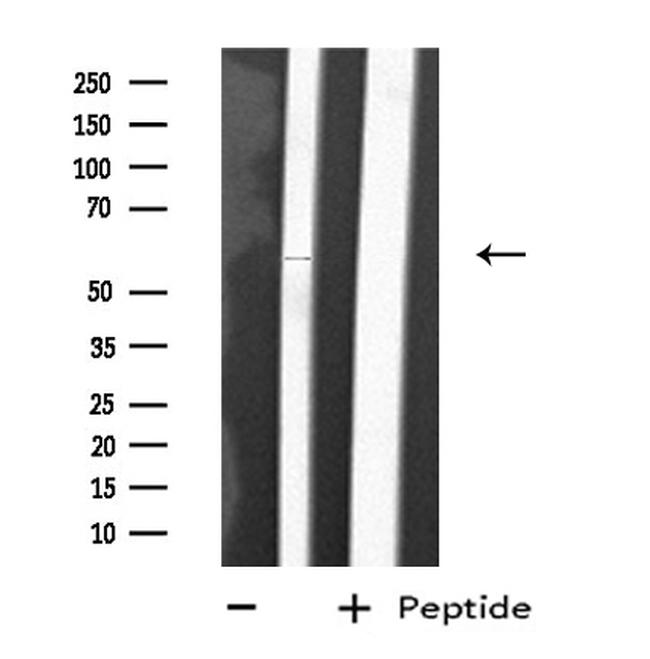 CYP2D6 Antibody in Western Blot (WB)