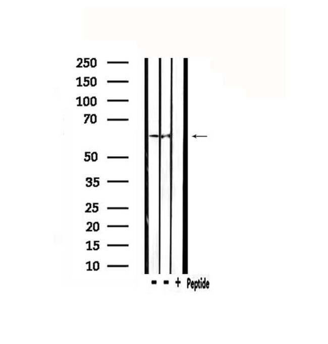 CYP2D6 Antibody in Western Blot (WB)