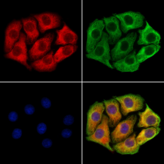 DYNC1I1 Antibody in Immunocytochemistry (ICC/IF)