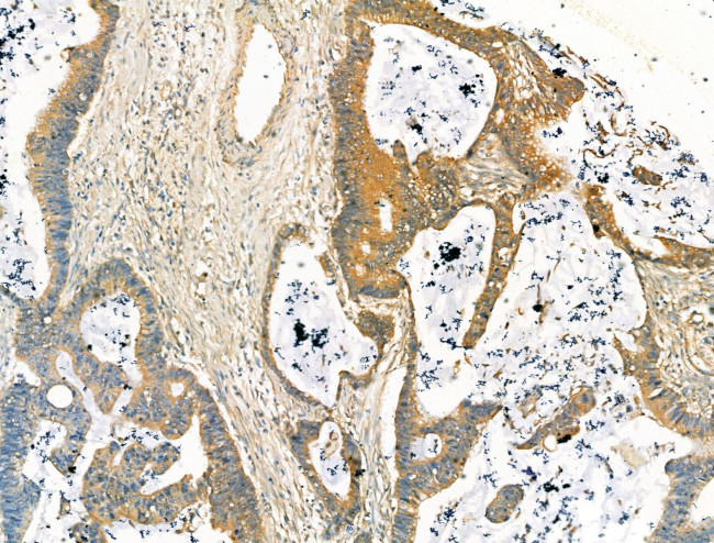 DYNC1I1 Antibody in Immunohistochemistry (Paraffin) (IHC (P))