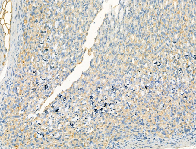 DYNC1I1 Antibody in Immunohistochemistry (Paraffin) (IHC (P))