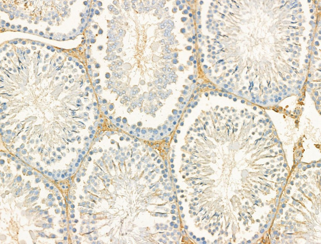 DYNC1I1 Antibody in Immunohistochemistry (Paraffin) (IHC (P))