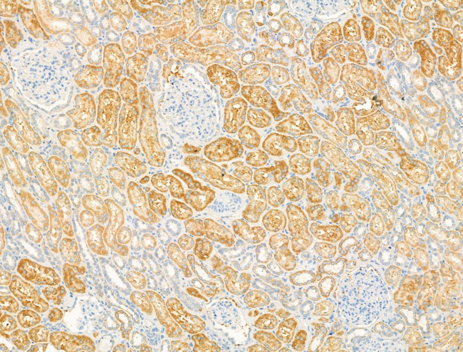 DYNC1I1 Antibody in Immunohistochemistry (Paraffin) (IHC (P))