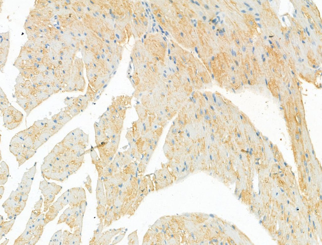 DYNC1I1 Antibody in Immunohistochemistry (Paraffin) (IHC (P))