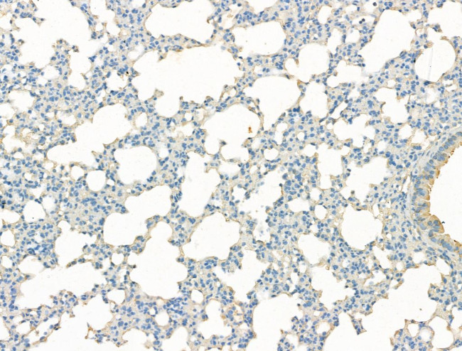 DYNC1I1 Antibody in Immunohistochemistry (Paraffin) (IHC (P))