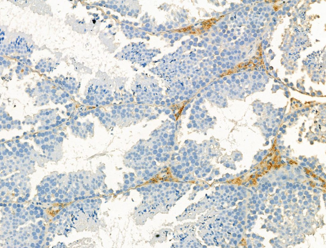 DYNC1I1 Antibody in Immunohistochemistry (Paraffin) (IHC (P))