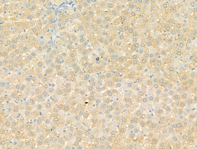 DYNC1I1 Antibody in Immunohistochemistry (Paraffin) (IHC (P))