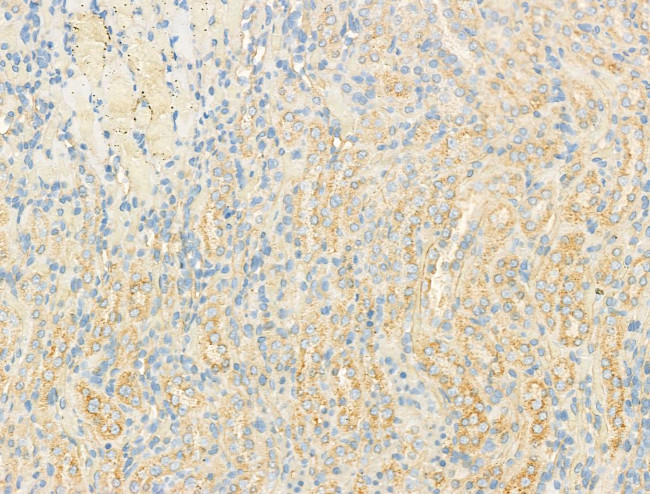 DYNC1I1 Antibody in Immunohistochemistry (Paraffin) (IHC (P))