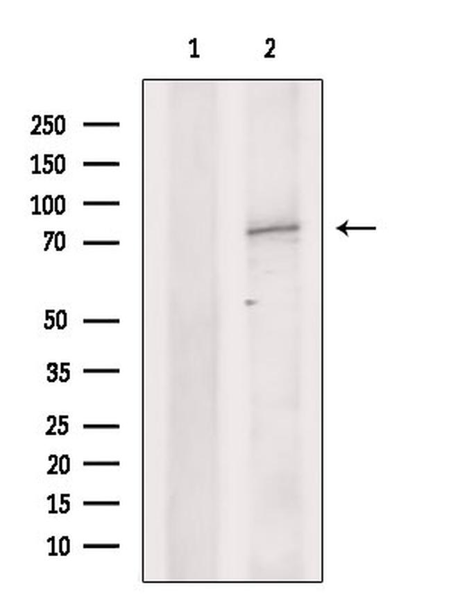 DYNC1I1 Antibody in Western Blot (WB)