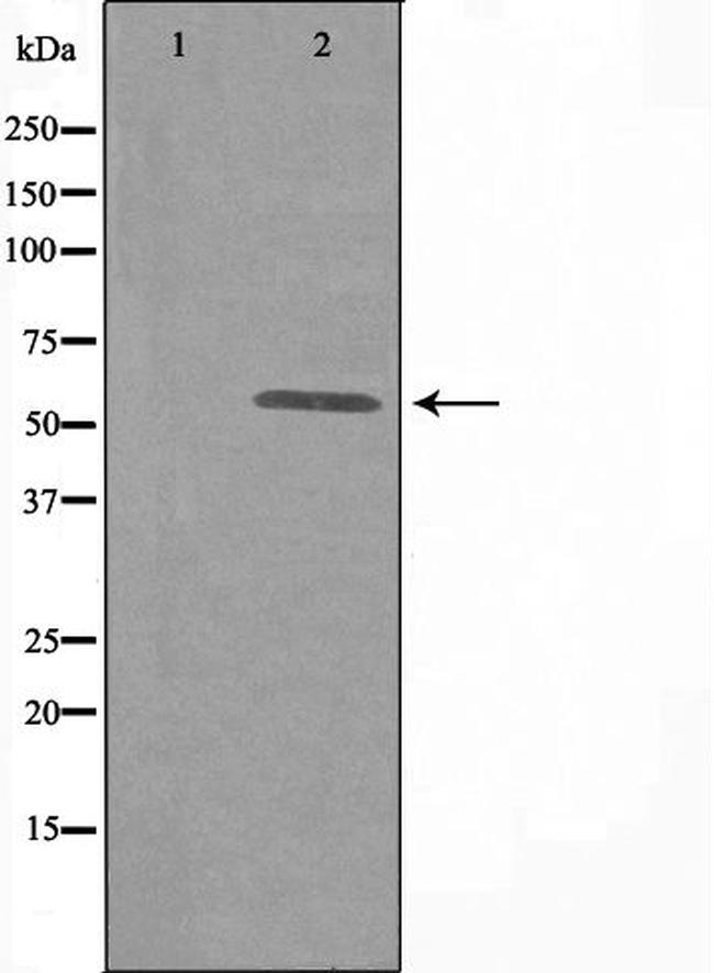 DAK Antibody in Western Blot (WB)